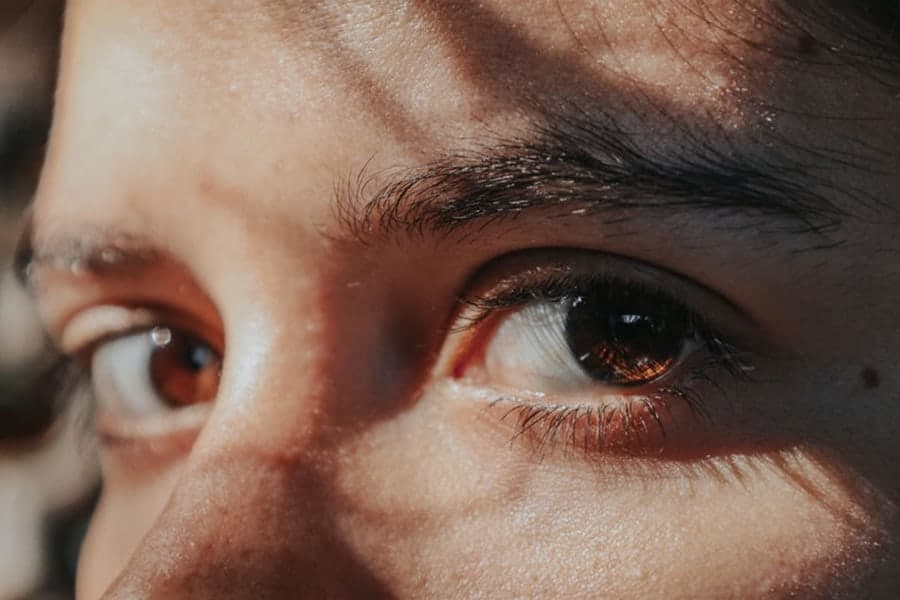anatomie yeux marron au soleil regard ophtalmo specialiste chirurgie cataracte paris dr camille rambaud
