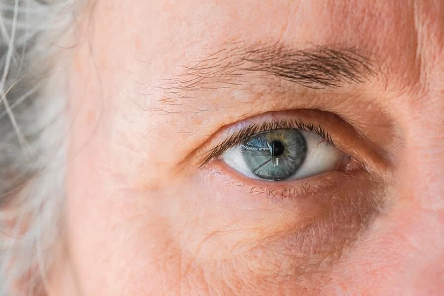 implant torique effets secondaires ophtalmo specialiste chirurgie cataracte paris dr camille rambaud