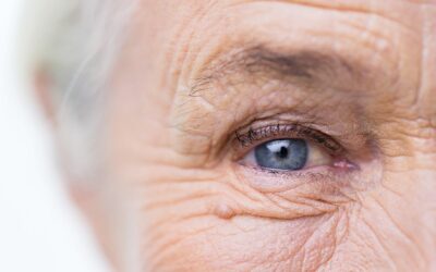 Comment sera ma vision après opération de la cataracte ?