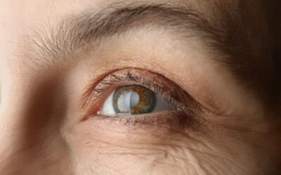 L’opération de la cataracte est-elle soumise à un âge limite ?
