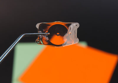 Implant cataracte : quelle matière est utilisée ?