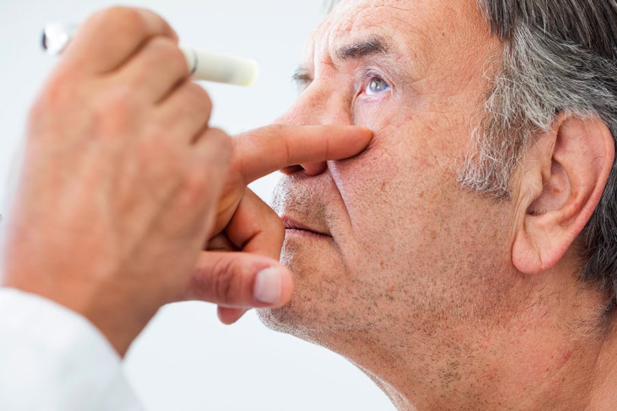 quand baisser tete apres operation de la cataracte ophtalmologiste specialiste chirurgie cataracte paris docteur camille rambaud